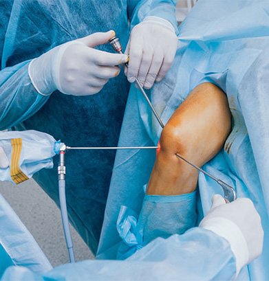 Arthroscopy